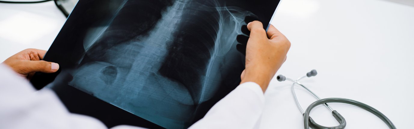 Medico che osserva una radiografia del torace con stetoscopio sul tavolo