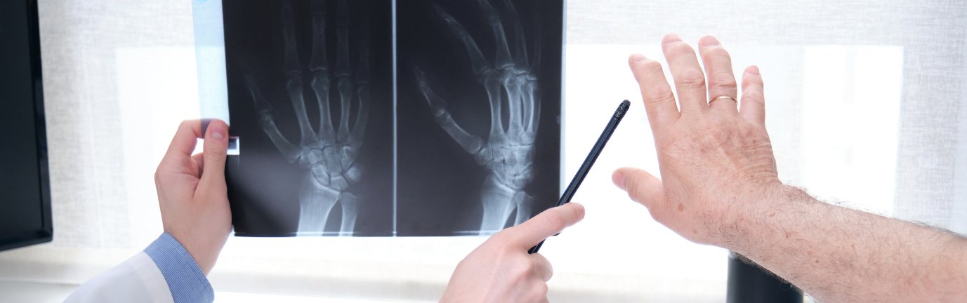 Medico analizza la radiografia della mano insieme a un paziente durante una visita reumatologica