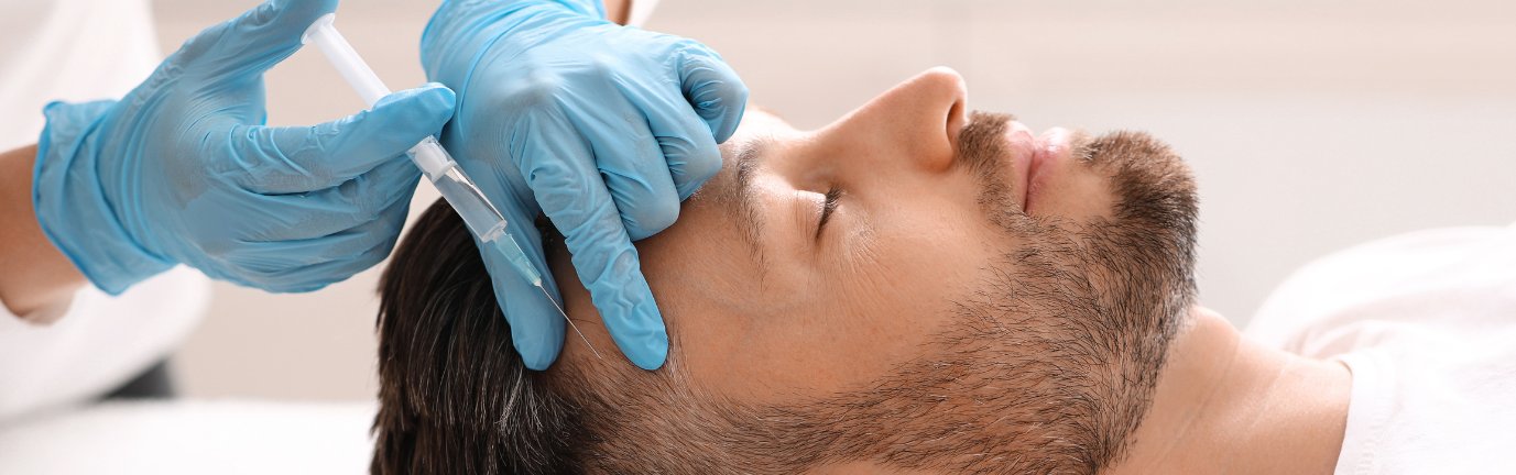 Trattamento PRP capelli su paziente uomo con iniezione nel cuoio capelluto