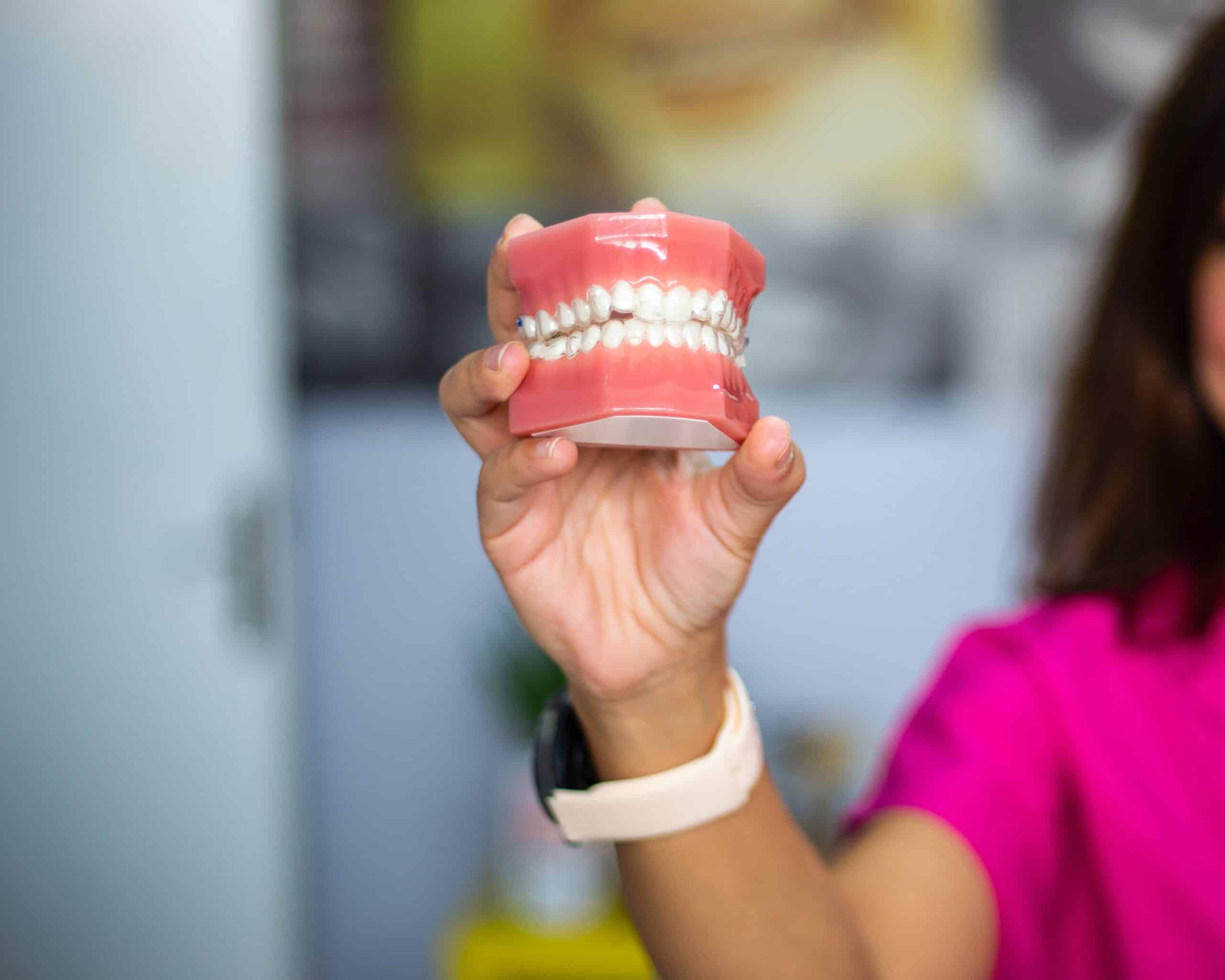 dental mold