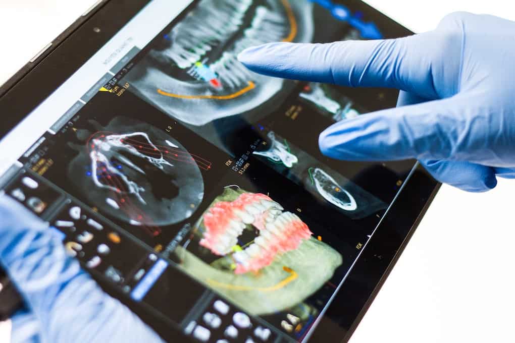 dentist reviewing x-rays