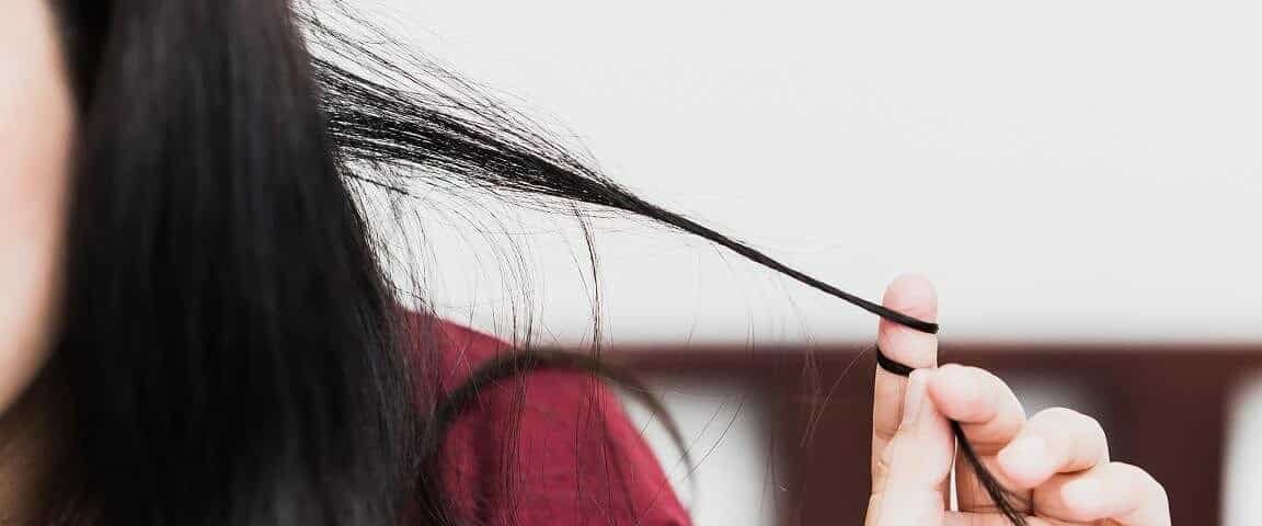 Trichotillomania