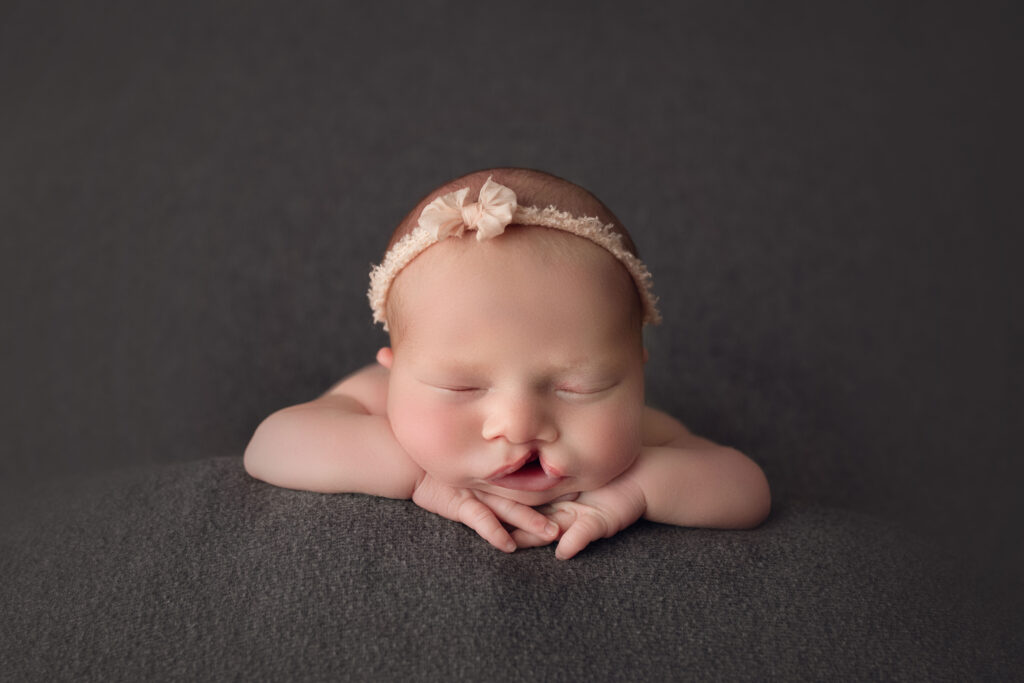 Newborn baby girl with cleft palate face forward on gray