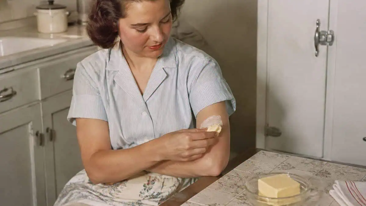 Home Remedies from the '50s Your Grandma Swore By 4 Vintage photo of first aid being applied calmly.