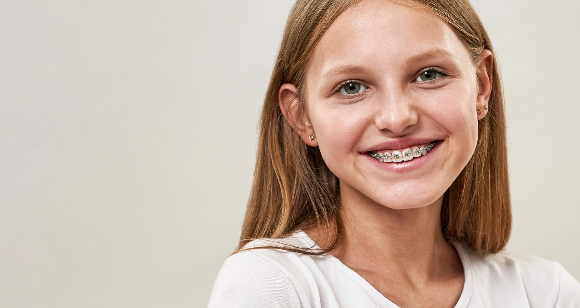 braces