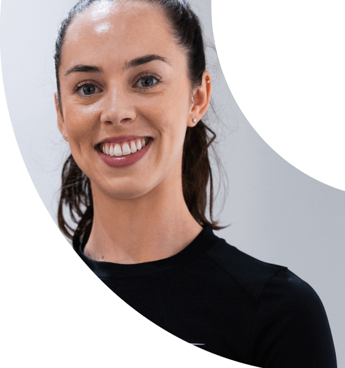 invisalign 2