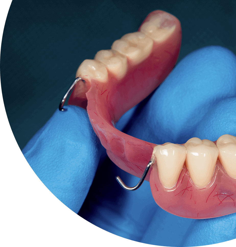 partial dentures
