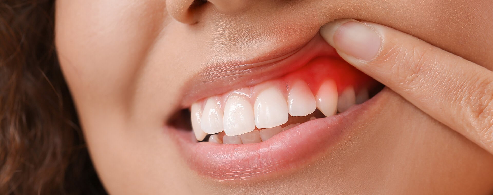 periodontal
