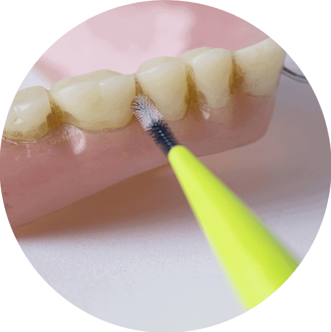 dentures3