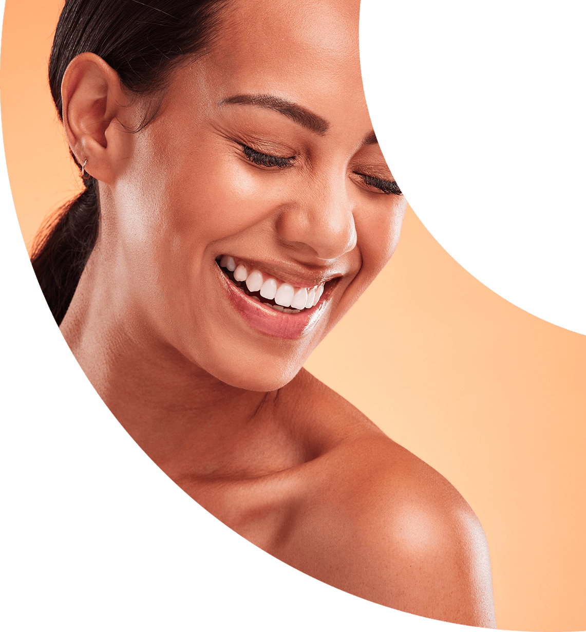 veneers 2 v2@2x