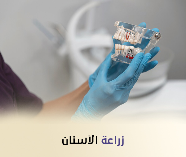 زراعة الأسنان بدون جراحة