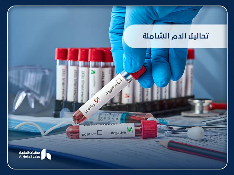 تحاليل الدم الشاملة: دليلك لفهم أهميتها وأماكن إجرائها في السعودية