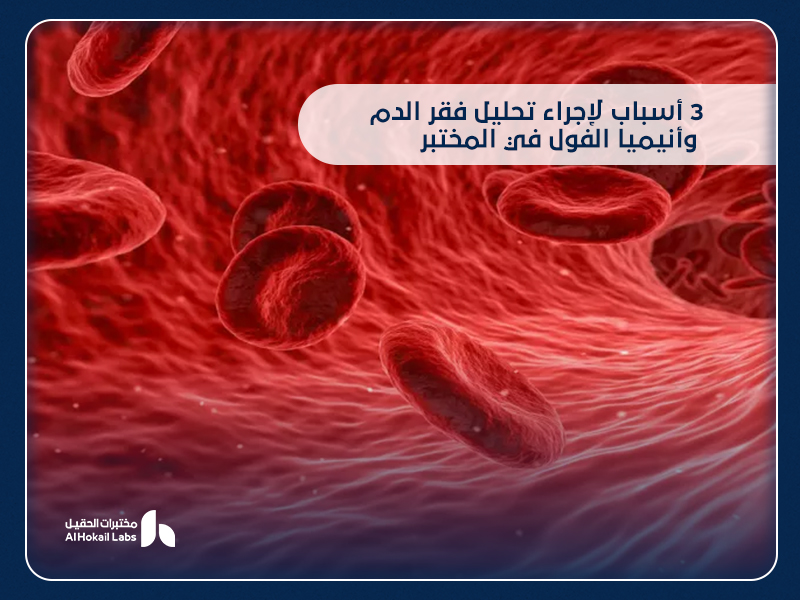 فقر الدم وأنيميا الفول: الأسباب، الأعراض، وطرق التشخيص من مختبرات الحقيل
