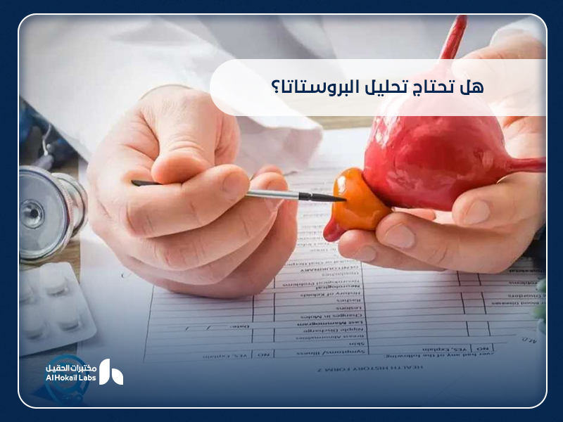 البروستاتا: الأعراض، الفحوصات، وأهمية التحليل المبكر في مختبرات الحقيل