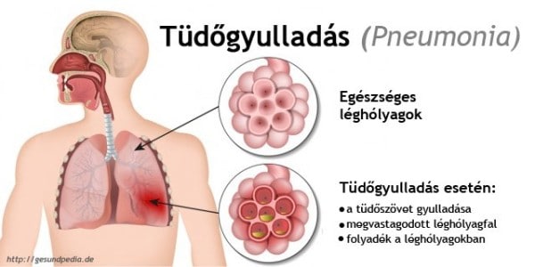 tudogyuladas