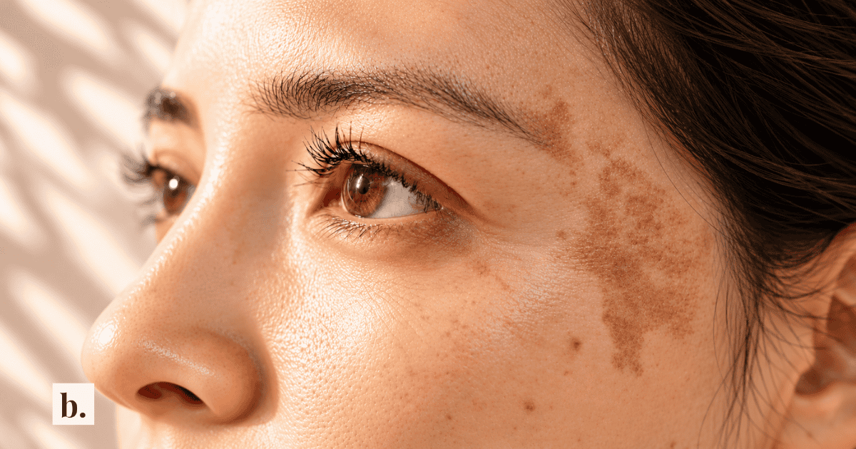 Which Dark-Spot Ingredients Actually Work? Why Different Pigmentation Technologies Aren't Automatically Better 4 Which Dark-Spot Ingredients Actually Work? Why Different Pigmentation Technologies Aren’t Automatically Better