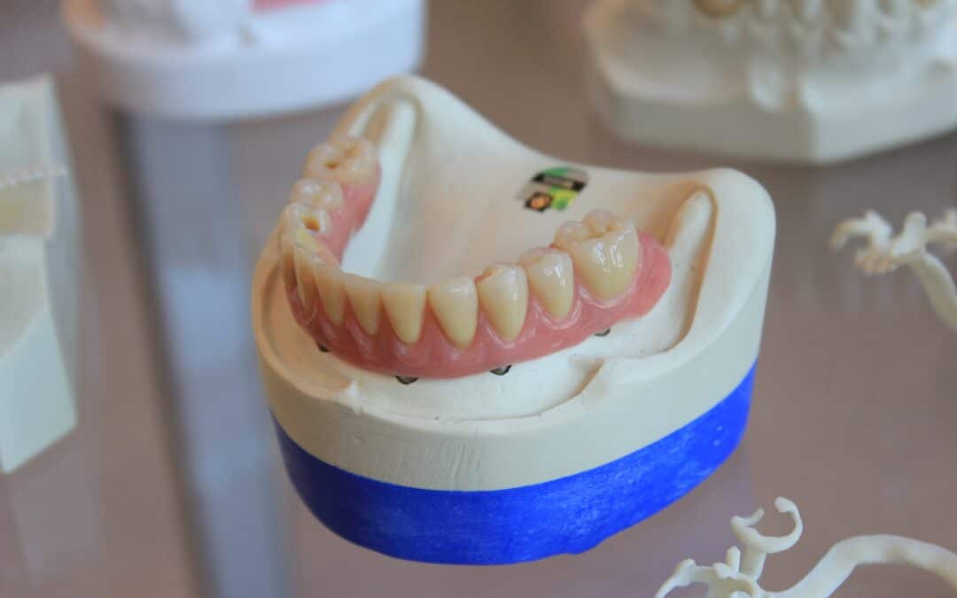 7 Ways to Make Your Dentures Last Longer