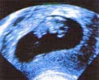 http://oloommagazine.com/images/Articles/11/SCI95b11N2_H01_004691.jpg