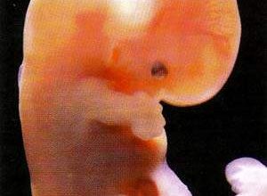 http://oloommagazine.com/images/Articles/15/SCI99b15N8-9_H03_009067.jpg