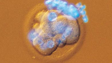 http://oloommagazine.com/images/Articles/18/SCI2002b18N2-3_H02_002156.jpg