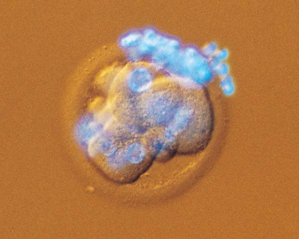 http://oloommagazine.com/images/Articles/18/SCI2002b18N2-3_H02_002156.jpg