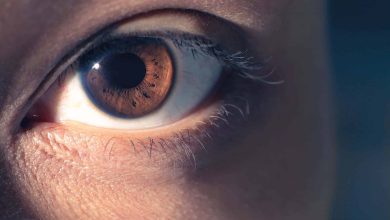 فحص العين