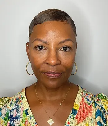 After - Facial Balancing / Fillers Patient 127