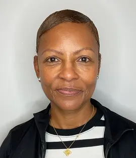 Before - Facial Balancing / Fillers Patient 127