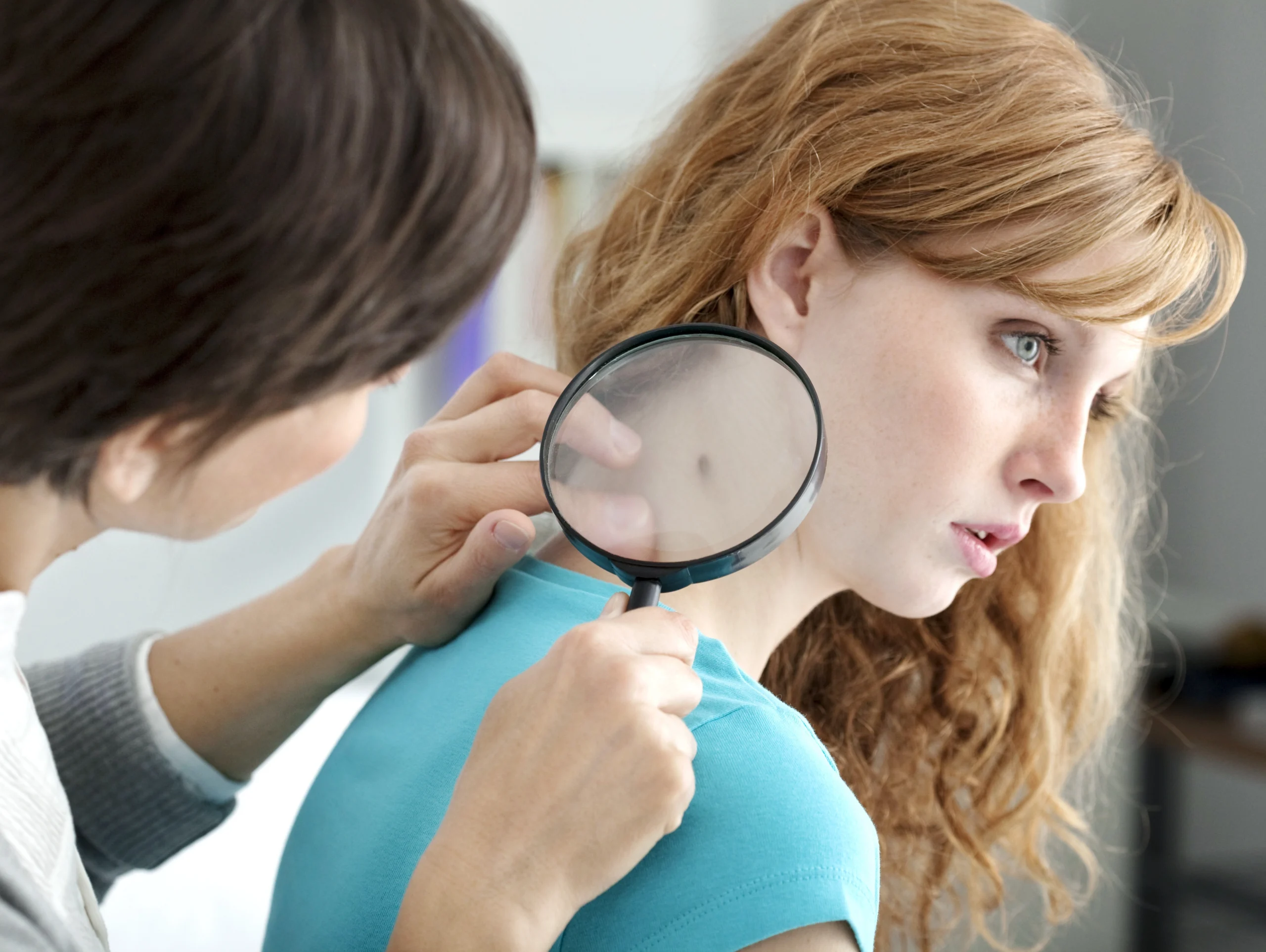 Woman with red hair and pale skin getting a medical dermatology skin check