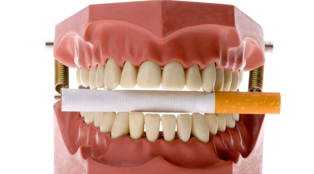 oral cancer screening