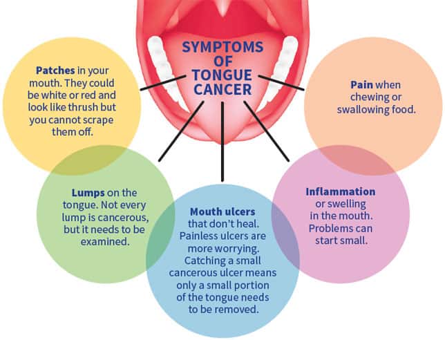 tongue cancer symptoms