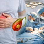 Οξεία χολοκυστίτιδα: πότε πρέπει να χειρουργείται;