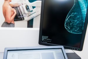 &nbsp;>thisisjustarandomplaceholder<Mammogram snapshot of breasts of a female patient on the monitor with undergoing mammography test on the background. Selective focus | Iberian Press®&nbsp;