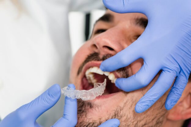 Dentist wearing blue gloves placing a clear dental aligner into a patient’s open mouth, teeth visible and gums relaxed (close-up)