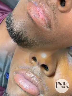 Healed dark lip color correction result showing balanced nude base in Lakeland FL