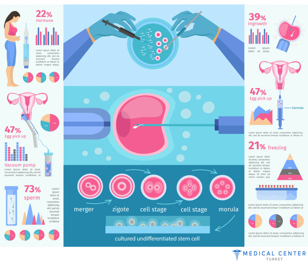 IVF treatment