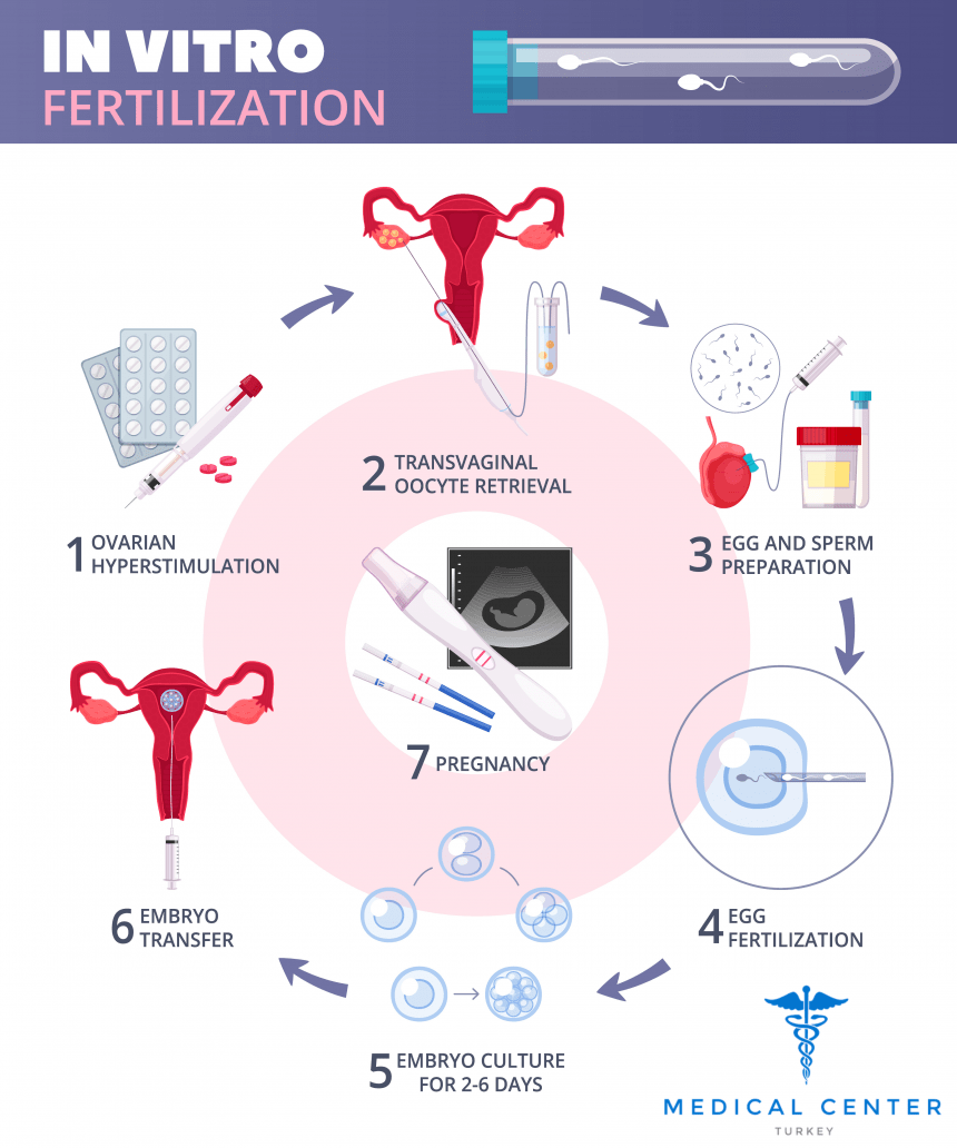 IVF process