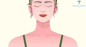 Neck Lift Cost in Turkey