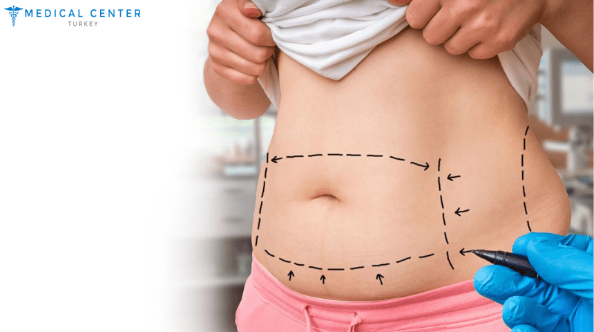 liposuction-in-turkey