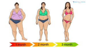 gastric sleeve surgery price 1