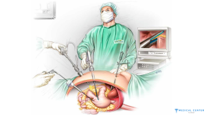 gastric sleeve surgery price 4