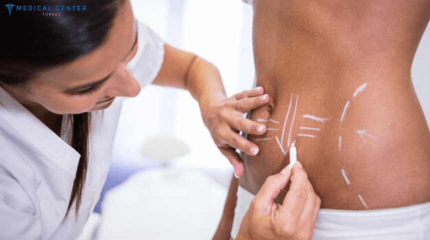 How_Much_Is_Liposuction_In_Turkey How_Much_Is_Liposuction_In_Turkey