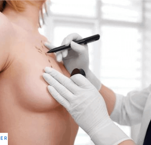 Boob Job in Turkey