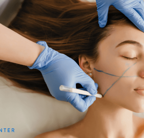Bichectomy Surgery Cost in Turkey Bichectomy Surgery Cost in Turkey
