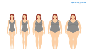 Body Mass Index (BMI) for Liposuction 1