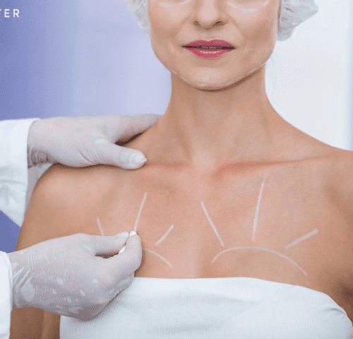 Breast Lift In Turkey