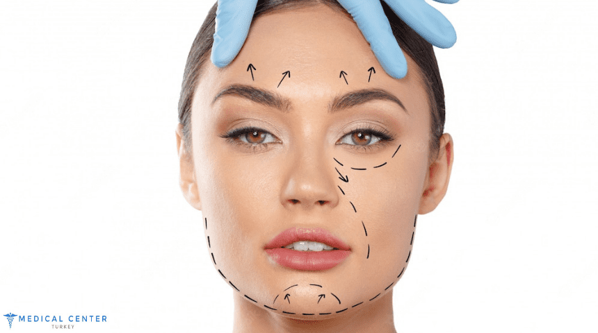 Bichectomy Surgery in Turkey