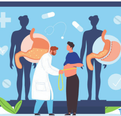 Obesity Surgery in Turkey Obesity Surgery in Turkey