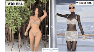 Does Kim Kardashian end the BBL Era?