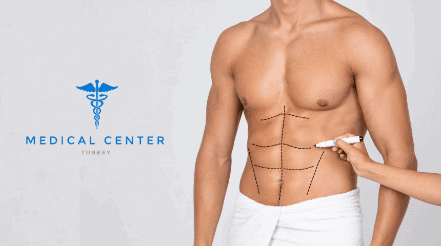 A Complete Guide to Liposuction for Men A Complete Guide to Liposuction for Men